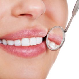 Fluoride Treatment Mesa