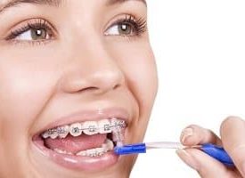 Orthodontist Mesa AZ