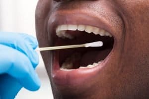 Jaw Bone Grafts