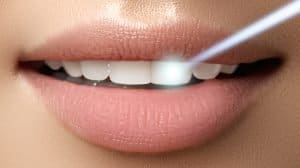 How Laser Dentistry Could Help Reduce Dental Anxiety